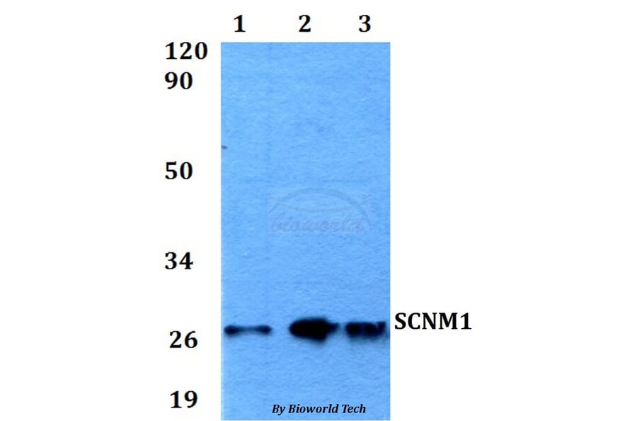 Anti-SCNM1 Antibody from Bioworld Technology (BS60558) - Antibodies.com