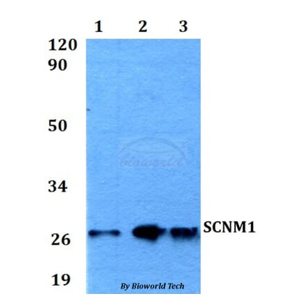 Anti-SCNM1 Antibody from Bioworld Technology (BS60558) - Antibodies.com
