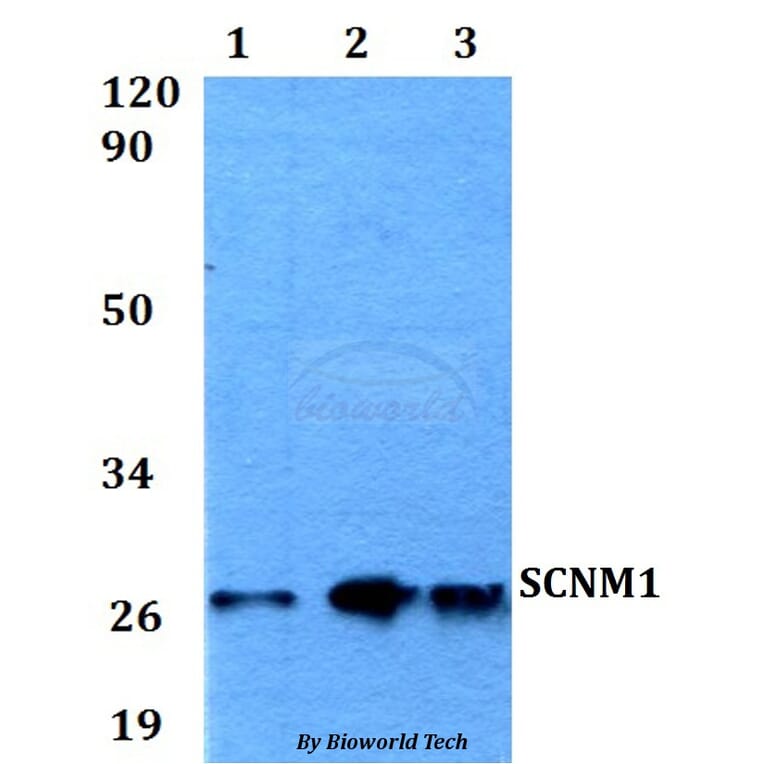 Anti-SCNM1 Antibody from Bioworld Technology (BS60558) - Antibodies.com