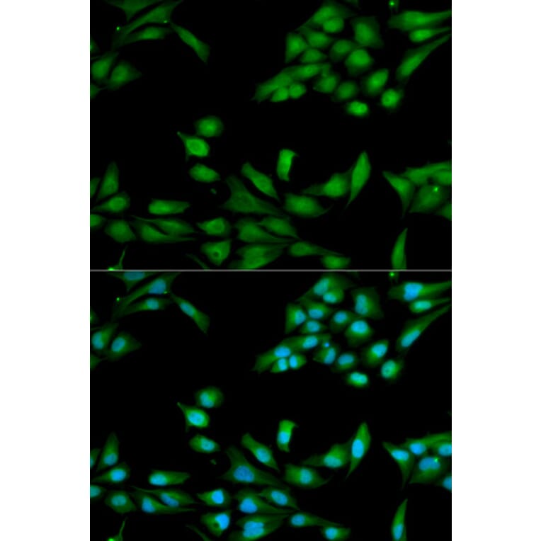 Anti-MSH2 Antibody from Bioworld Technology (BS6056) - Antibodies.com