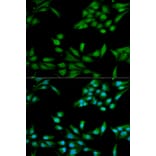 Anti-MSH2 Antibody from Bioworld Technology (BS6056) - Antibodies.com