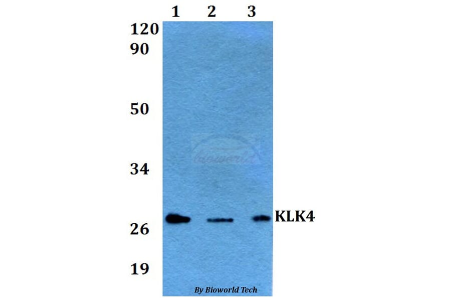 Anti-KLK4 Antibody from Bioworld Technology (BS60564) - Antibodies.com