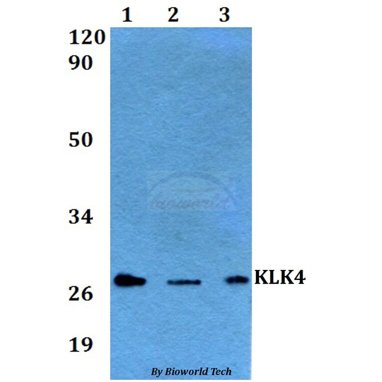 Anti-KLK4 Antibody from Bioworld Technology (BS60564) - Antibodies.com