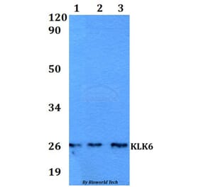 Anti-KLK6 Antibody from Bioworld Technology (BS60565) - Antibodies.com