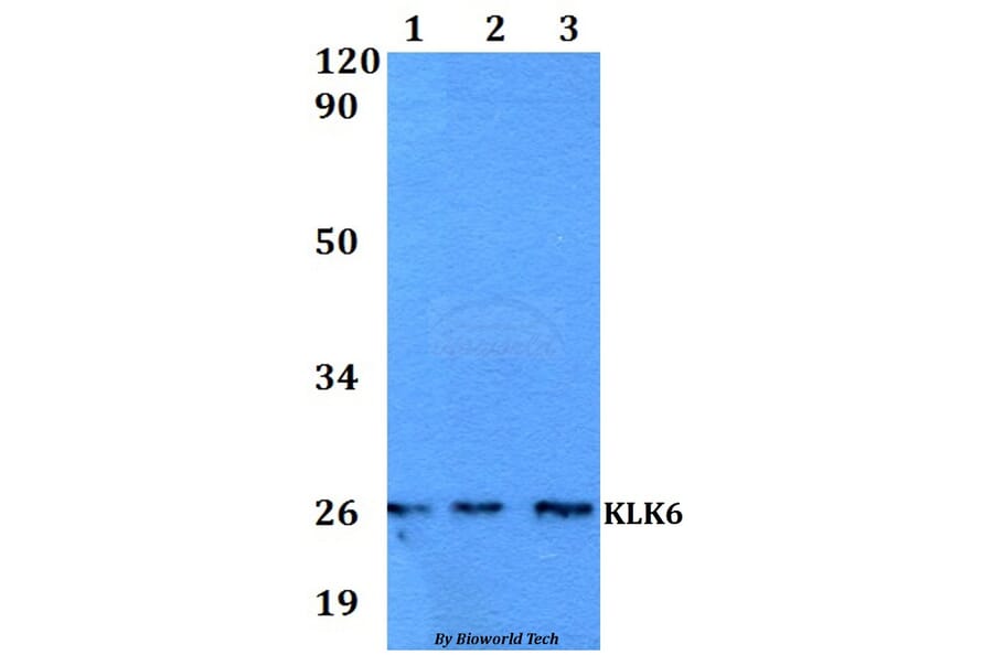 Anti-KLK6 Antibody from Bioworld Technology (BS60565) - Antibodies.com