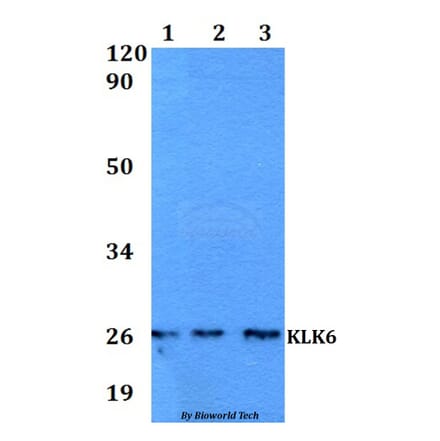 Anti-KLK6 Antibody from Bioworld Technology (BS60565) - Antibodies.com
