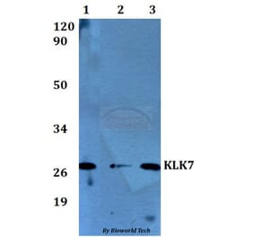 Anti-KLK7 Antibody from Bioworld Technology (BS60566) - Antibodies.com