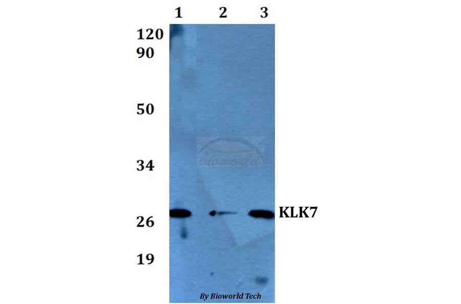 Anti-KLK7 Antibody from Bioworld Technology (BS60566) - Antibodies.com