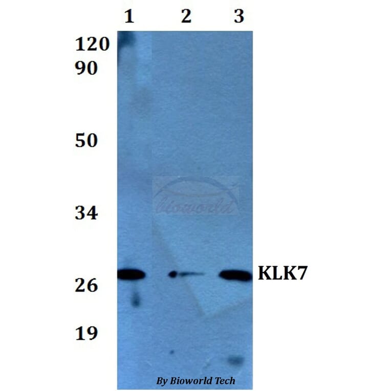 Anti-KLK7 Antibody from Bioworld Technology (BS60566) - Antibodies.com