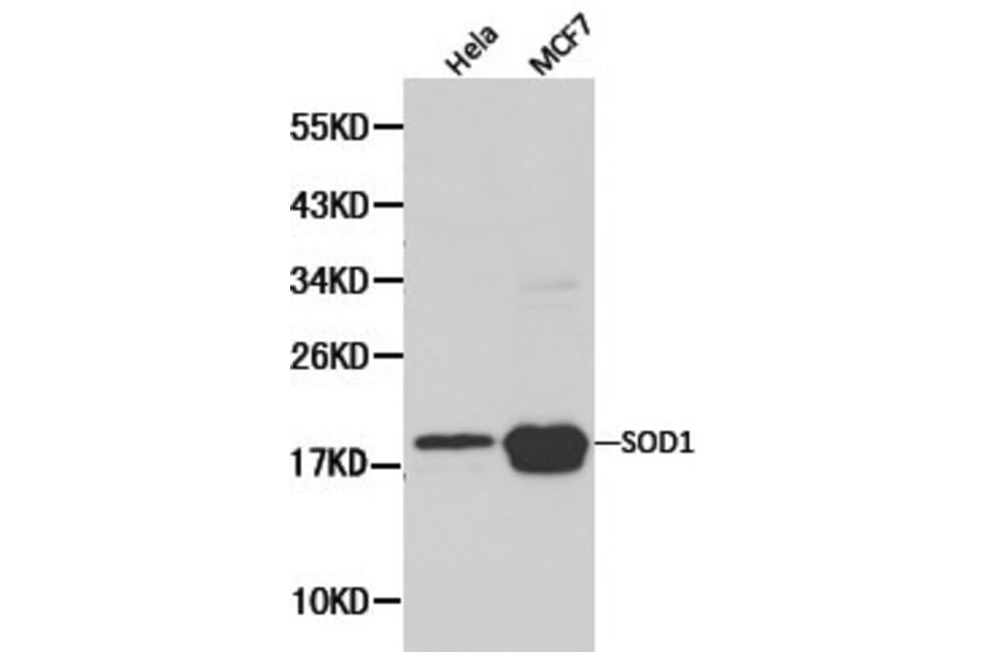Anti-SOD1 Antibody from Bioworld Technology (BS6057) - Antibodies.com