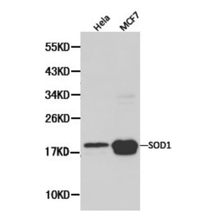 Anti-SOD1 Antibody from Bioworld Technology (BS6057) - Antibodies.com
