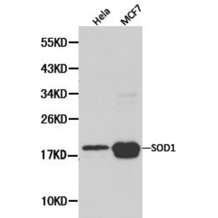 Anti-SOD1 Antibody from Bioworld Technology (BS6057) - Antibodies.com