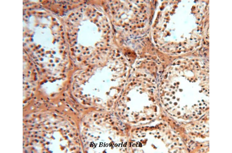 Anti-SOD1 Antibody from Bioworld Technology (BS6057) - Antibodies.com
