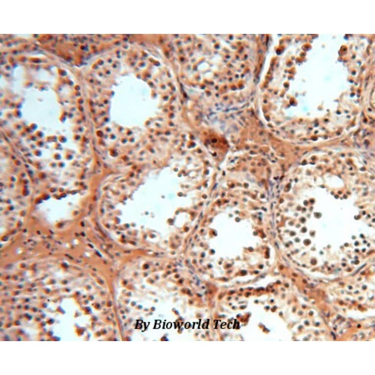 Anti-SOD1 Antibody from Bioworld Technology (BS6057) - Antibodies.com