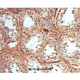 Anti-SOD1 Antibody from Bioworld Technology (BS6057) - Antibodies.com