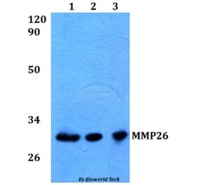 Anti-MMP26 Antibody from Bioworld Technology (BS60573) - Antibodies.com