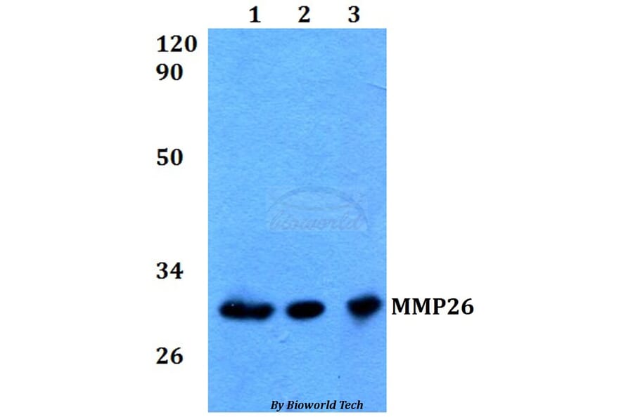 Anti-MMP26 Antibody from Bioworld Technology (BS60573) - Antibodies.com