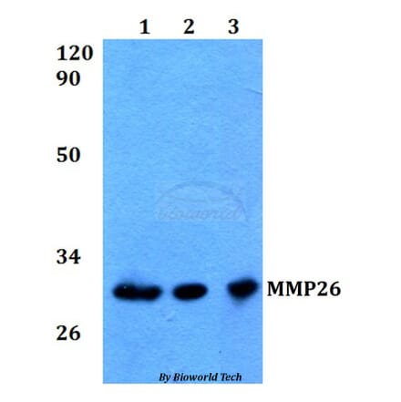 Anti-MMP26 Antibody from Bioworld Technology (BS60573) - Antibodies.com