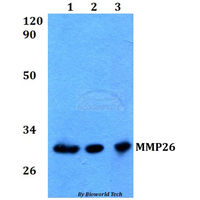 Anti-MMP26 Antibody from Bioworld Technology (BS60573) - Antibodies.com