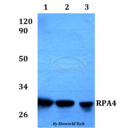 Anti-RPA4 Antibody from Bioworld Technology (BS60574) - Antibodies.com