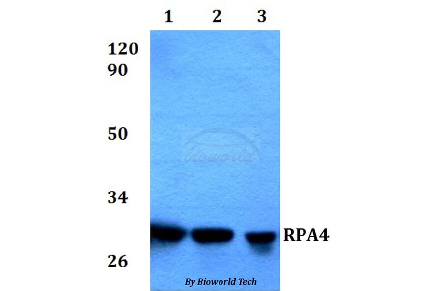 Anti-RPA4 Antibody from Bioworld Technology (BS60574) - Antibodies.com