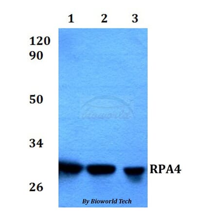 Anti-RPA4 Antibody from Bioworld Technology (BS60574) - Antibodies.com