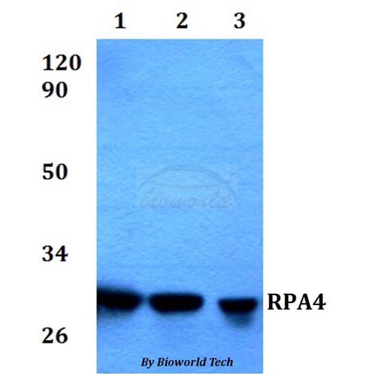 Anti-RPA4 Antibody from Bioworld Technology (BS60574) - Antibodies.com