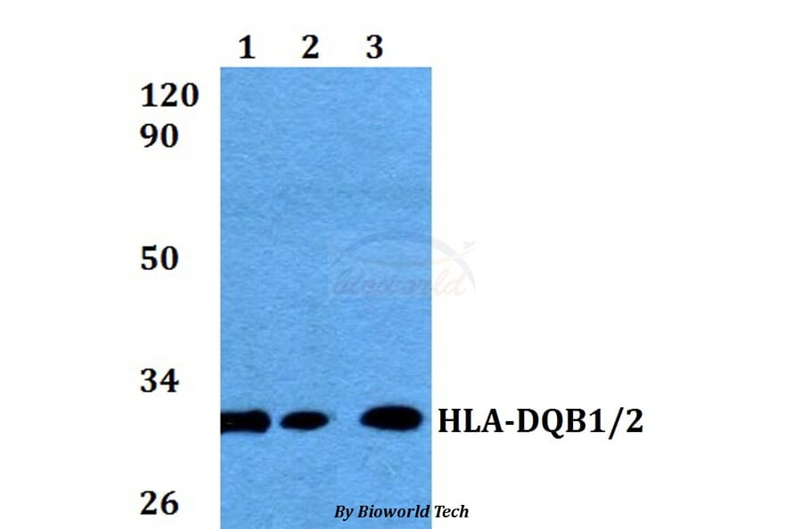 Anti-HLA-DQB1/B2 Antibody from Bioworld Technology (BS60575) - Antibodies.com