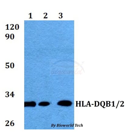 Anti-HLA-DQB1/B2 Antibody from Bioworld Technology (BS60575) - Antibodies.com