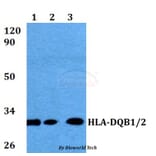 Anti-HLA-DQB1/B2 Antibody from Bioworld Technology (BS60575) - Antibodies.com
