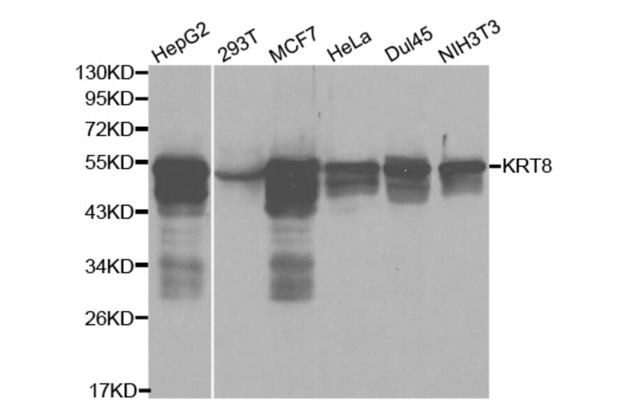 Anti-Cytokeratin 8 Antibody from Bioworld Technology (BS6058) - Antibodies.com