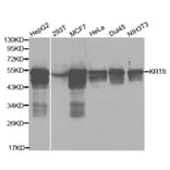 Anti-Cytokeratin 8 Antibody from Bioworld Technology (BS6058) - Antibodies.com