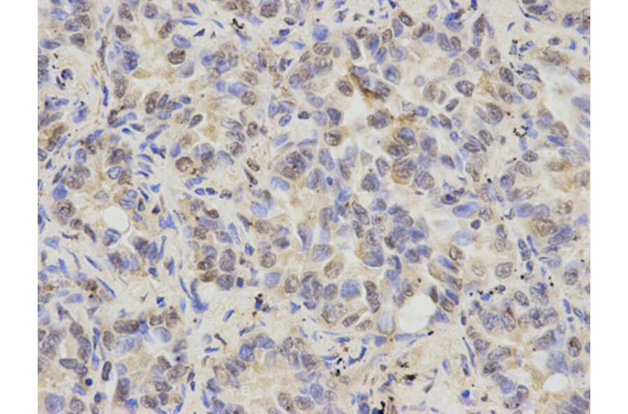 Anti-Cytokeratin 8 Antibody from Bioworld Technology (BS6058) - Antibodies.com