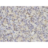 Anti-Cytokeratin 8 Antibody from Bioworld Technology (BS6058) - Antibodies.com
