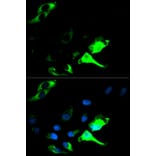 Anti-Cytokeratin 8 Antibody from Bioworld Technology (BS6058) - Antibodies.com