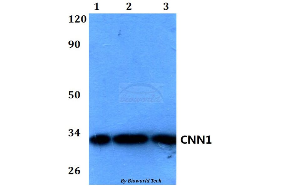 Anti-CNN1 Antibody from Bioworld Technology (BS60580) - Antibodies.com