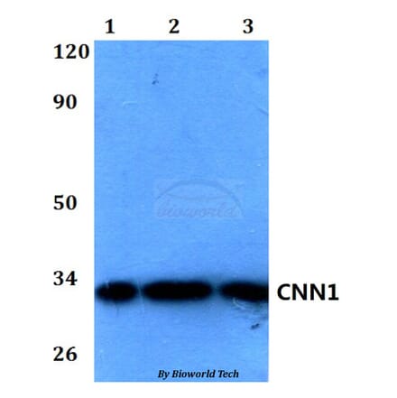 Anti-CNN1 Antibody from Bioworld Technology (BS60580) - Antibodies.com