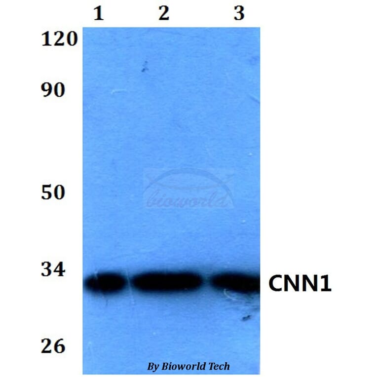 Anti-CNN1 Antibody from Bioworld Technology (BS60580) - Antibodies.com