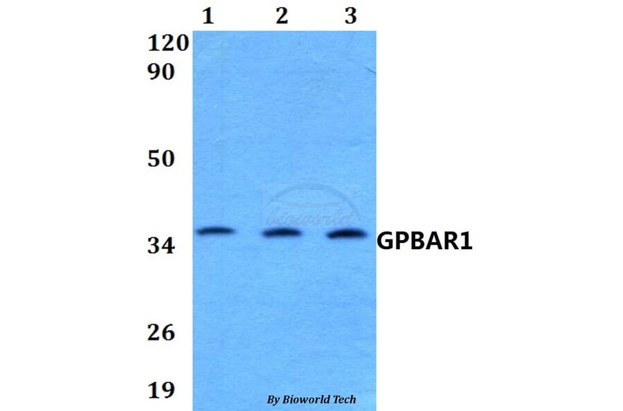 Anti-GPBAR1 Antibody from Bioworld Technology (BS60582) - Antibodies.com