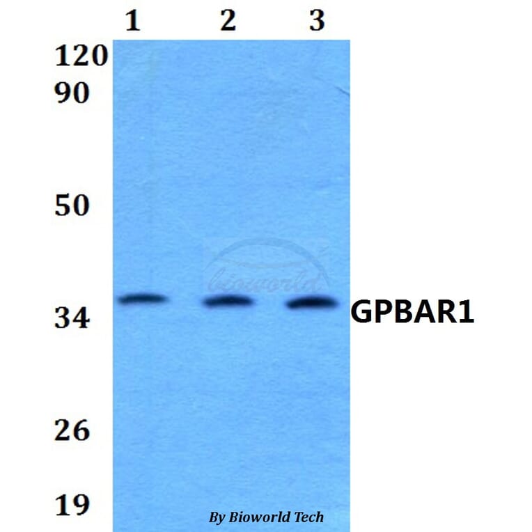 Anti-GPBAR1 Antibody from Bioworld Technology (BS60582) - Antibodies.com