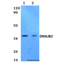 Anti-DNAJB2 Antibody from Bioworld Technology (BS60583) - Antibodies.com