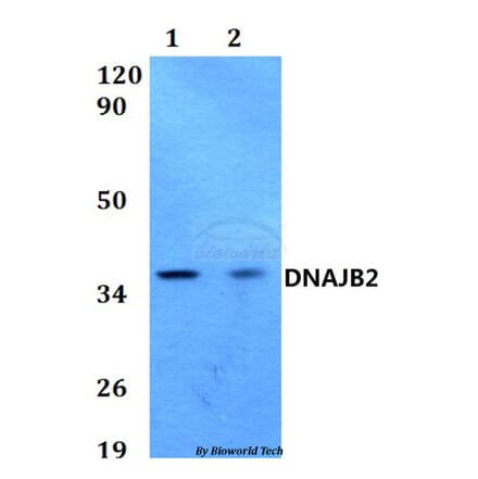 Anti-DNAJB2 Antibody from Bioworld Technology (BS60583) - Antibodies.com