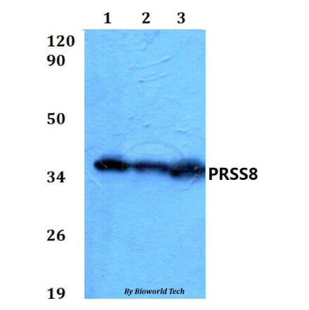 Anti-PRSS8 Antibody from Bioworld Technology (BS60585) - Antibodies.com
