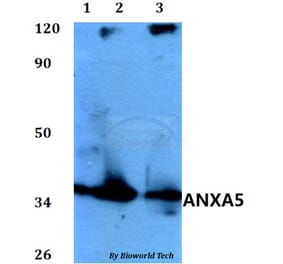 Anti-ANXA5 Antibody from Bioworld Technology (BS60587) - Antibodies.com