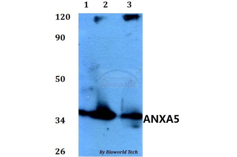 Anti-ANXA5 Antibody from Bioworld Technology (BS60587) - Antibodies.com