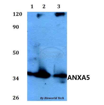 Anti-ANXA5 Antibody from Bioworld Technology (BS60587) - Antibodies.com