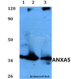 Anti-ANXA5 Antibody from Bioworld Technology (BS60587) - Antibodies.com