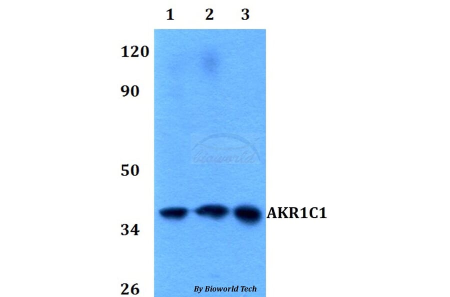 Anti-AKR1C1 Antibody from Bioworld Technology (BS60589) - Antibodies.com