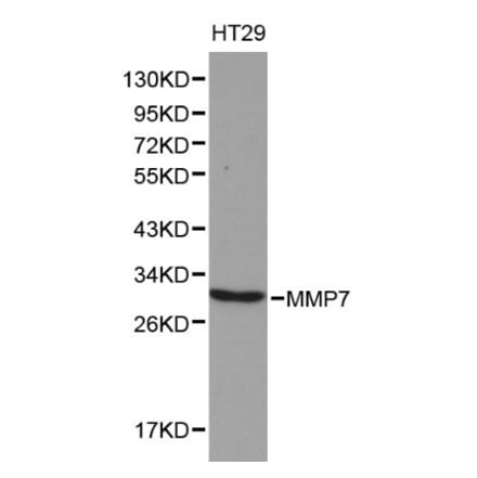Anti-MMP-7 Antibody from Bioworld Technology (BS6059) - Antibodies.com