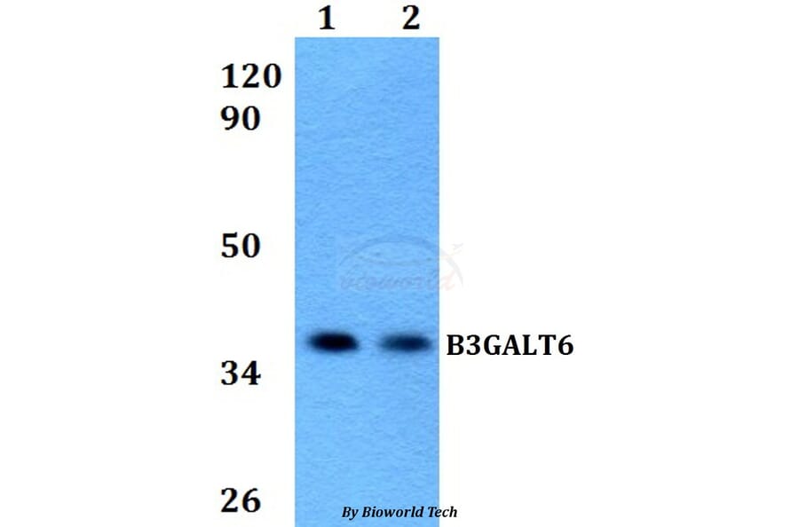 Anti-B3GALT6 Antibody from Bioworld Technology (BS60590) - Antibodies.com